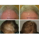 HairMax Лазерная кепка HairMax Laser 272 PowerFlex
