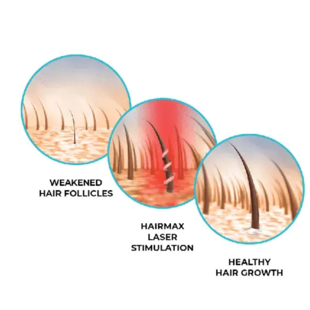 HairMax Лазерная кепка HairMax Laser 272 PowerFlex