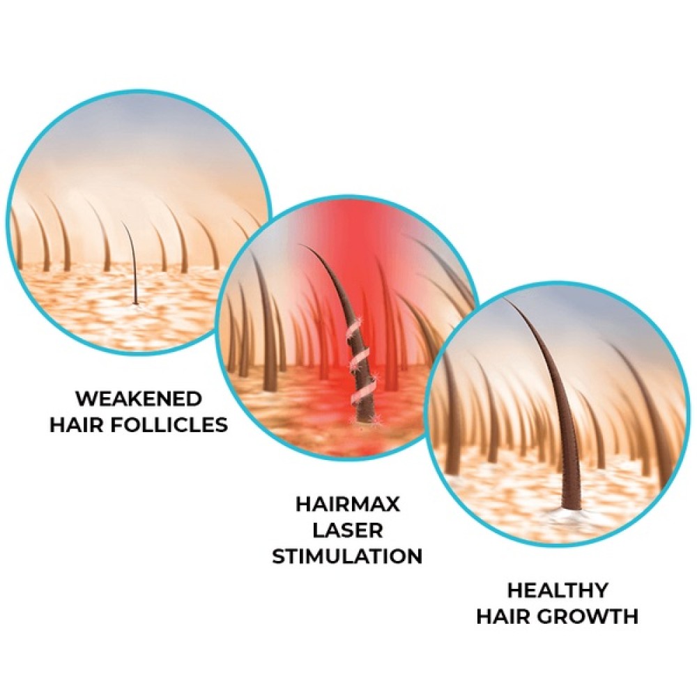 HairMax LaserBand 41 - ComfortFlex Лазерный обруч (16960)
