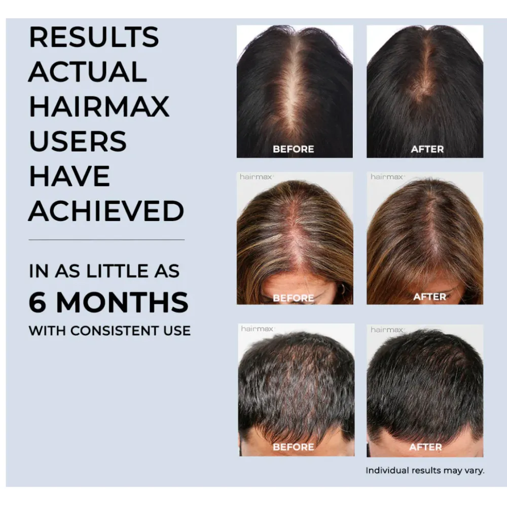 HairMax ACTONIS™ 18 DUAL ACTION LASERCOMB — лазерная расчёска