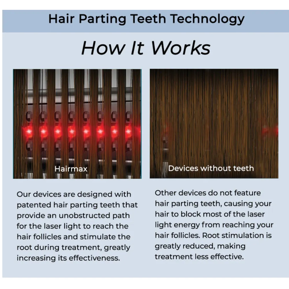 HairMax ACTONIS™ 18 DUAL ACTION LASERCOMB — лазерная расчёска