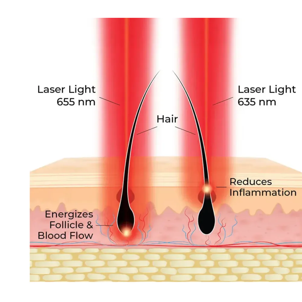 HairMax ACTONIS™ 18 DUAL ACTION LASERCOMB — лазерная расчёска